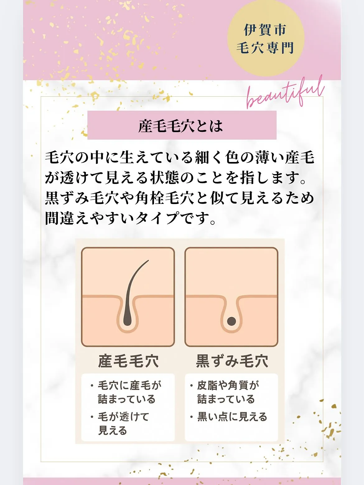 🌸こんにちは 毛穴専門サロンKOHAです🌸